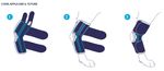 balto-tutore-hock-garretto-applicazione